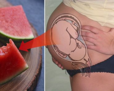 Pregnant Women Eat Watermelon, This Can Happened to Your Baby!
