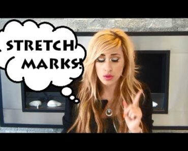 MY Pregnancy Stretchmarks & Advice to Pregnant Women – Will they fade?  — ❤ — DYNA
