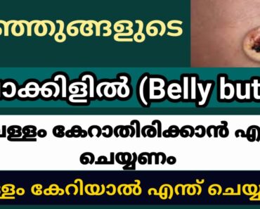 How To Care Newborn babies Bellybutton /parenting tip/malayalam