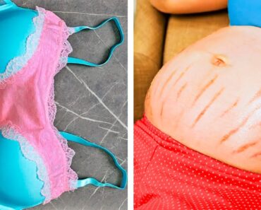 20 PREGNANCY HACKS EVERY WOMAN SHOULD KNOW