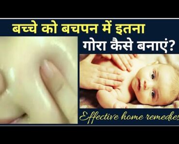 Best 5 Natural tips to make your baby's skin fair 25 February 2019