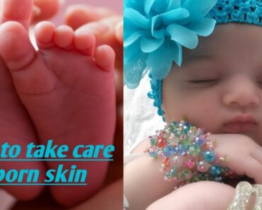 How to reduce newborn baby's dry skin?/ Newborn skin care tips(in English)