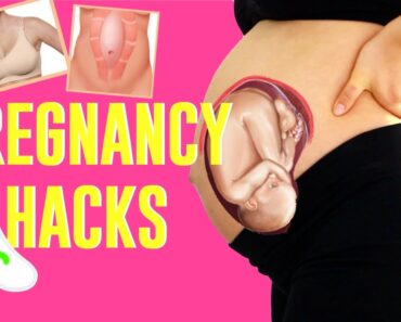 Pregnancy Hacks!! | How To Prevent Stretch Marks, DIY and Abs!