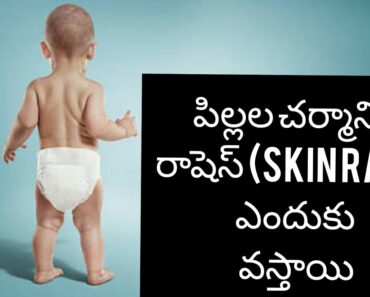 పిల్లల చర్మానికి రాషెస్ ఎందుకు వస్తాయి/baby skin Rash tips/New born baby telugu tips channel