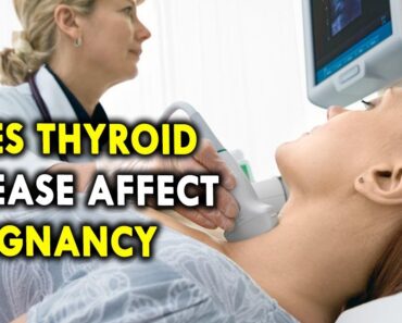 Does Thyroid Disease Affect Pregnancy – Health Care Tips for Pregnant Women