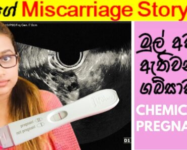මගේ Miscarriage Story එක | මුල් අවදියේ ඇතිවන ගබ්සාවන් – Pregnancy Tips Sinhala