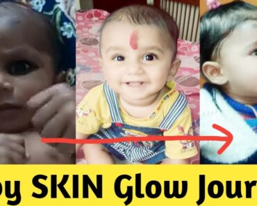 My Baby SKINCARE Routine|Babies Skin Whitening Permanently|Skincare tips|HowToGet fair skin SKYLIGHT