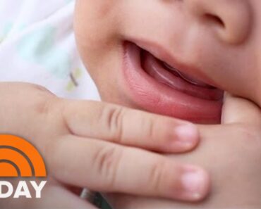 How To Deal With Teething: New Baby Basics | TODAY