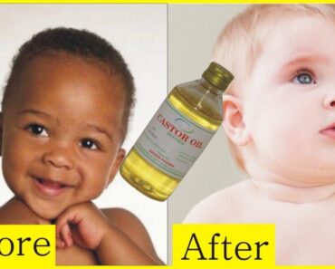 How To Get Baby Skin Whitening Naturally | Skin Whitening | Babies Beauty Tips In Urdu