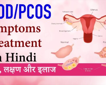 PCOD Problem Solution in Hindi Home Remedies Pregnancy Gharelu Upay | PCOS Treatment Symptoms Hindi