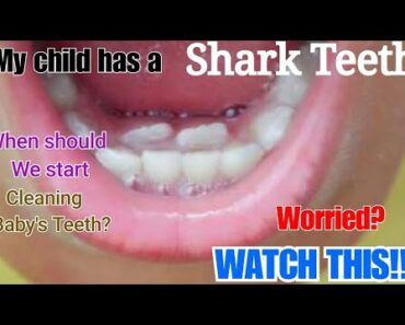 CHILDREN'S DENTAL HEALTH/Advice for Parents/Shark Teeth/Tips for good dental care