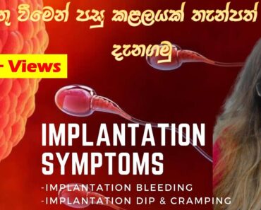 Implantation Symptoms | Implantation Bleeding | Early Pregnancy Sign | Implantation Dip Sinhala