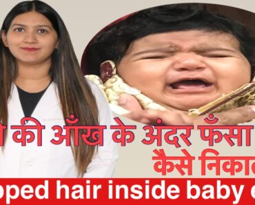 How to remove trapped hair inside newborn baby eye | newborn eye cleaning tips in Hindi |