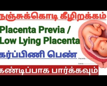 Nanji kodi Kezhirakkam(Full Explanation) || Low Lying Placenta || Placenta Previa || Pregnancy Tips