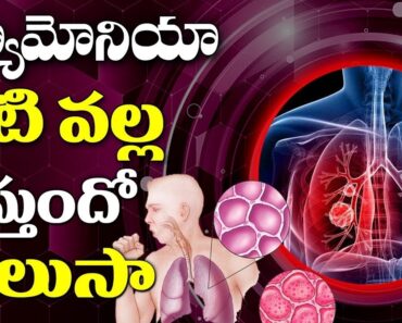 Pneumonia Treatment at Home For Baby | Health Tips For Pneumonia | Health Tips | Health Online