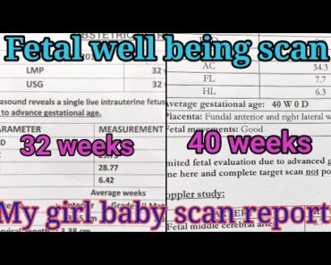 My girl baby fetal well being|fetal growth scan reports|Pregnancy tips|Aayushi RS