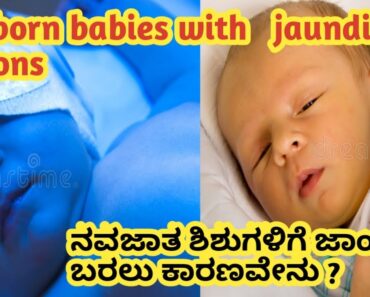 newborn babies jaundice problem l ನವಜಾತ ಶಿಶುಗಳಿಗೆ ಜಾಂಡೀಸ್ ಬರಲು ಕಾರಣವೇನು l ನಿವಾರಣೆ ಹೇಗೆ?