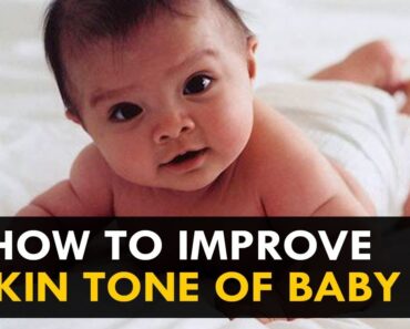 How To improve Skin Tone of Baby – Health Sutra