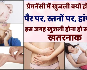 प्रेगनेंसी में खुजली क्यों होती है | Pregnancy me Khujli ka Karan Upay | Itching During Pregnancy
