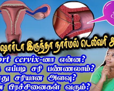 short cervix during pregnancy in tamil/cervix dilation/karupai vai length/cervical stiches/#reshu