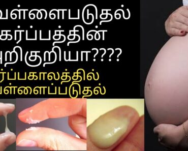 white discharge during pregnancy | pregnancy tips in tamil | pregnancy symptoms in tamil