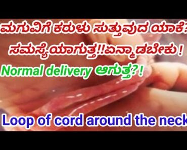 Cord around fetal neck during pregnancy in kannada|pregnancy tips|Aayshi RS