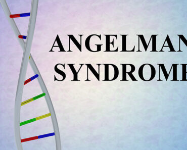 Angelman Syndrome: Symptoms, Causes And Treatment