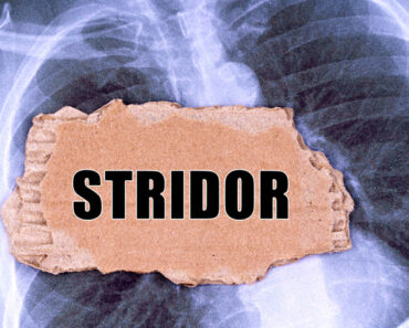 Stridor (Noisy Breathing) In Children: Causes And Treatment