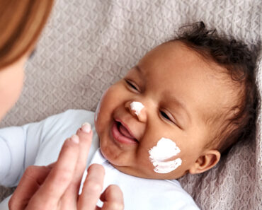 3 common baby skin conditions and how to treat them