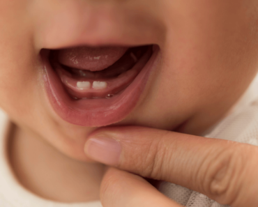 Can Babies be Born with Teeth?